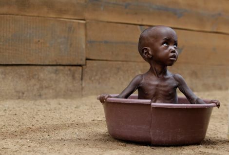 More than 60,000 Somali children are severly hit by hunger - Photo: DEC